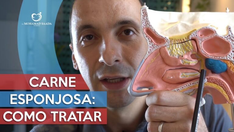 Sintomas da Carne Esponjosa na Garganta