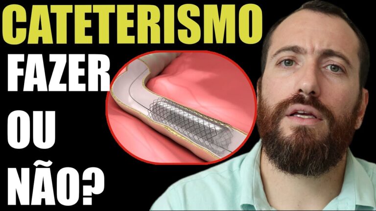 Cateter para Cateterismo Card&iacute;aco: Import&acirc;ncia e Aplica&ccedil;&otilde;es