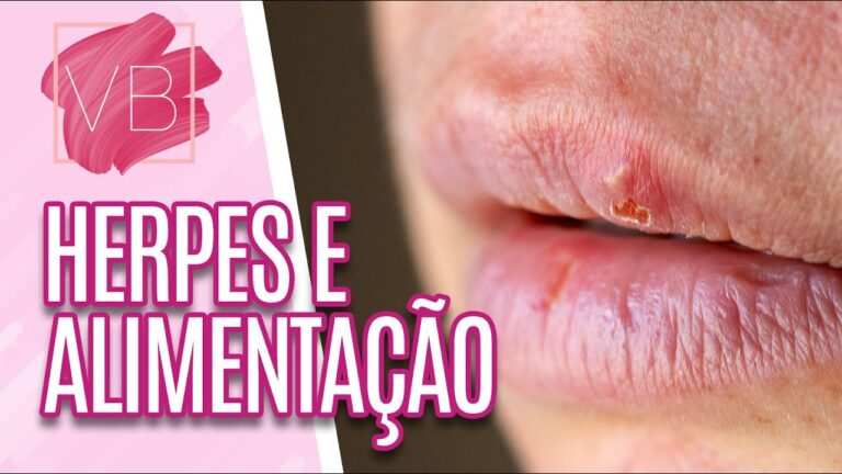 Benef&iacute;cios da Banana Rica em Lisina