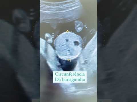 Como Calcular o Peso do Bebê de Forma Eficiente
