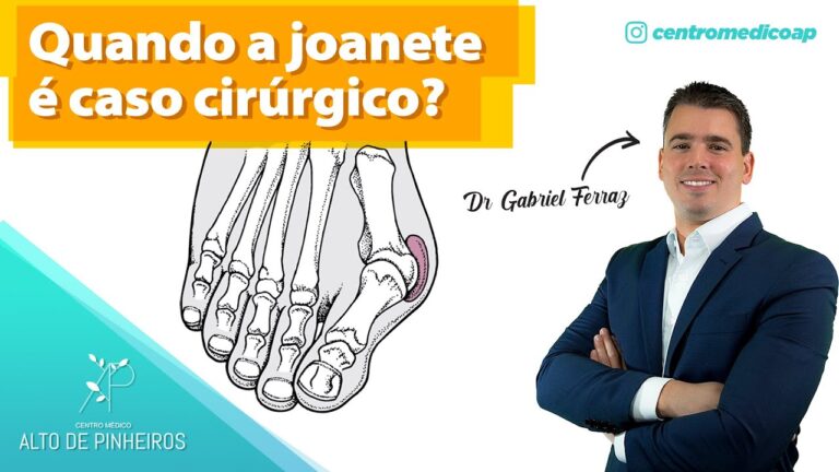 Joanete: Entenda a Import&acirc;ncia do Raio X na Diagn&oacute;stica