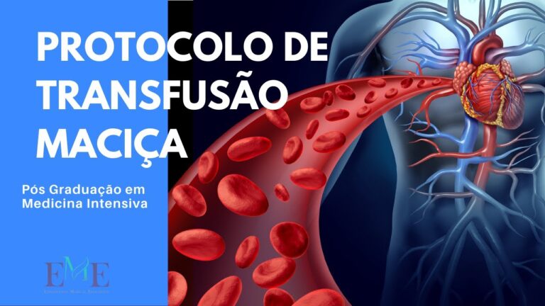 Transfus&atilde;o Maci&ccedil;a: Abordagem e Implica&ccedil;&otilde;es Cl&iacute;nicas