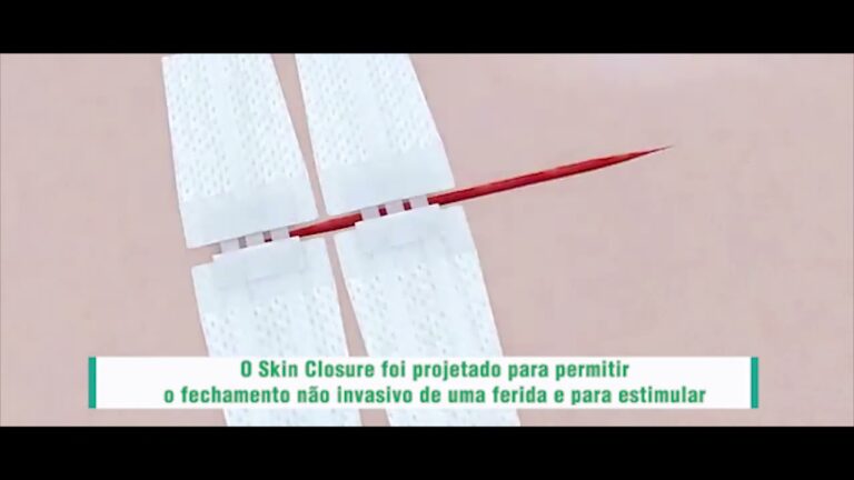 Adesivo Ideal para Pontos Cirúrgicos: Segurança e Eficiência