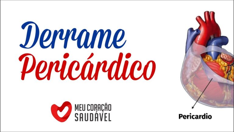 Derrame no Pericárdio: Possibilidades de Cura e Tratamento