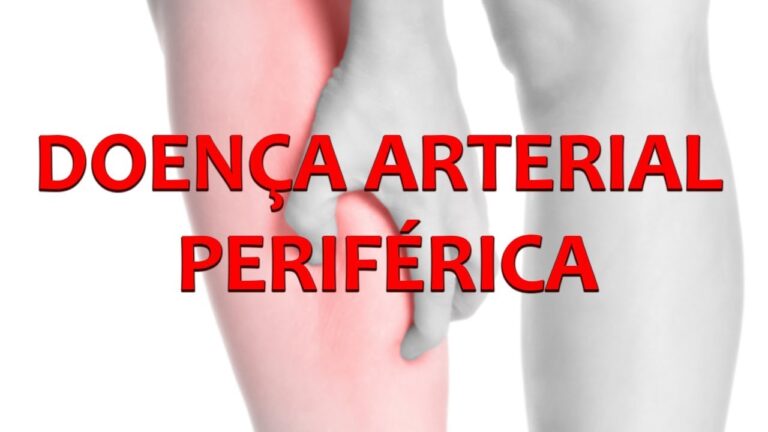Entendendo a Doença Vascular Periférica: Causas e Tratamentos