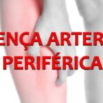 N&oacute;dulo n&atilde;o calcificado no pulm&atilde;o: diagn&oacute;stico e tratamento