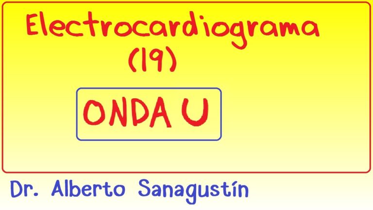 Onda U no ECG: Interpretação e Importância Clínica
