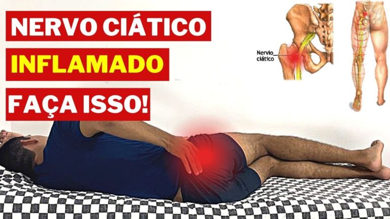 Como Aliviar a Dor no Nervo Ciático