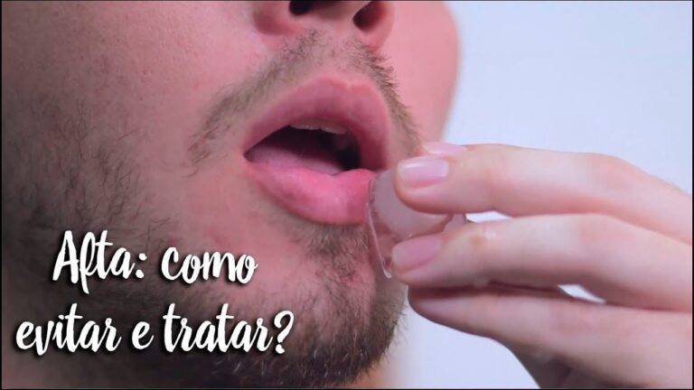 Listerine e Afta: Eficácia Comprovada na Cicatrização