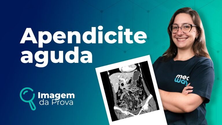 Imagens Impactantes de Cirurgia de Apendicite Supurada