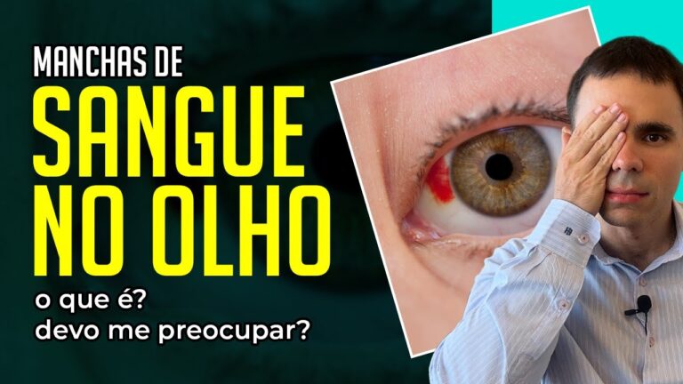 Sangue nos Olhos: Significado e Interpretações