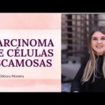 Cirurgia de Tendão na Mão: Tudo o Que Você Precisa Saber