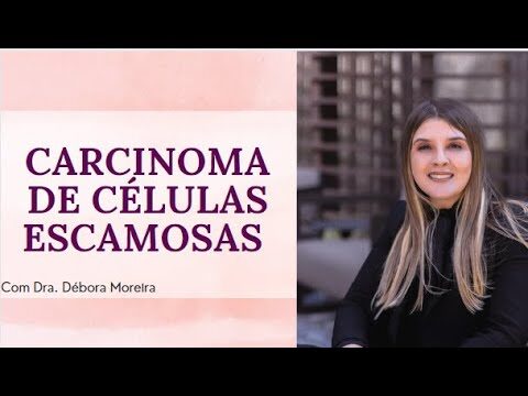 Cura para Carcinoma de Células Escamosas: Possibilidades e Avanços