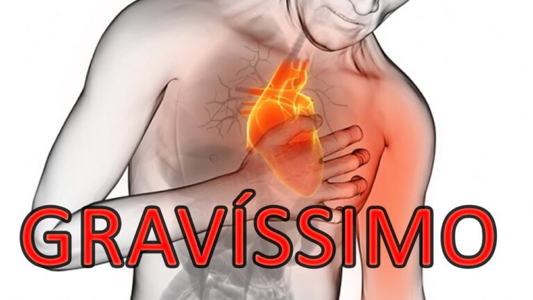 Reconhecendo os Sinais do Choque Cardiogênico