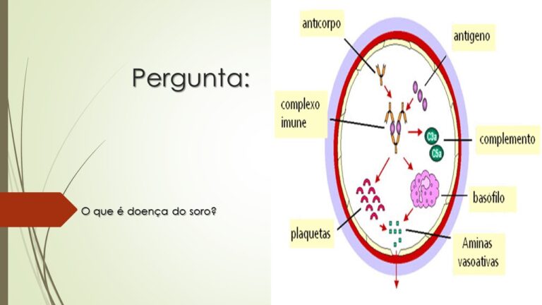 Entendendo a Doen&ccedil;a do Soro: Causas e Sintomas