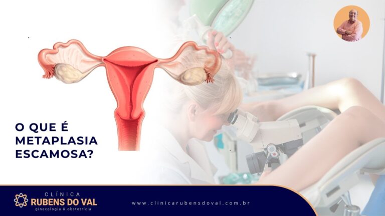 Metaplasia do Epitélio: Causas e Implicações Clínicas