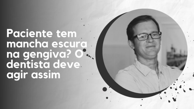 Como Tratar a Mancha Escura no Dente Perto da Gengiva