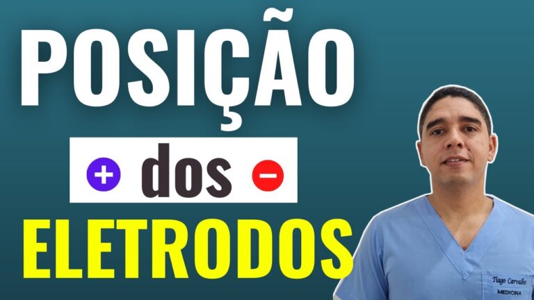 Entendendo a Posição do ECG para Diagnóstico Eficaz