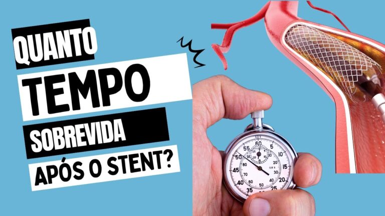 Sintomas Pós-Angioplastia com Stent: O Que Esperar?