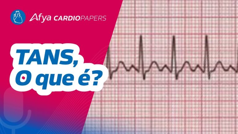 Taquicardia Atrial Não Sustentada: Causas e Tratamentos
