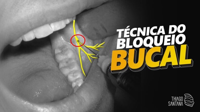 Benefícios do Anestésico Bucal na Odontologia
