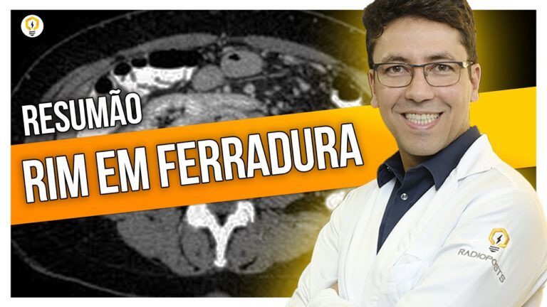 Rim Ferradura: Possibilidades de Tratamento e Cura