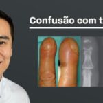 Como Aliviar Cicatriz Co&ccedil;ando: Dicas e Tratamentos