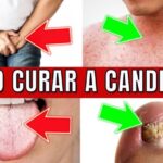 Dor cervical irradiando para o braço: causas e tratamentos