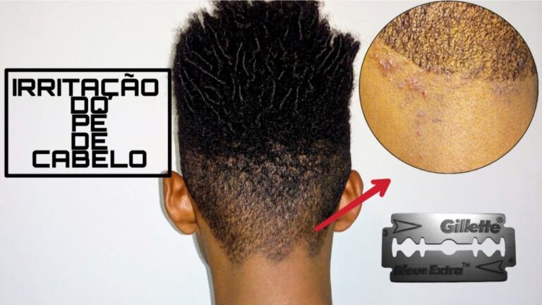 Alergia na Cabeça Após Corte de Cabelo: Causas e Soluções