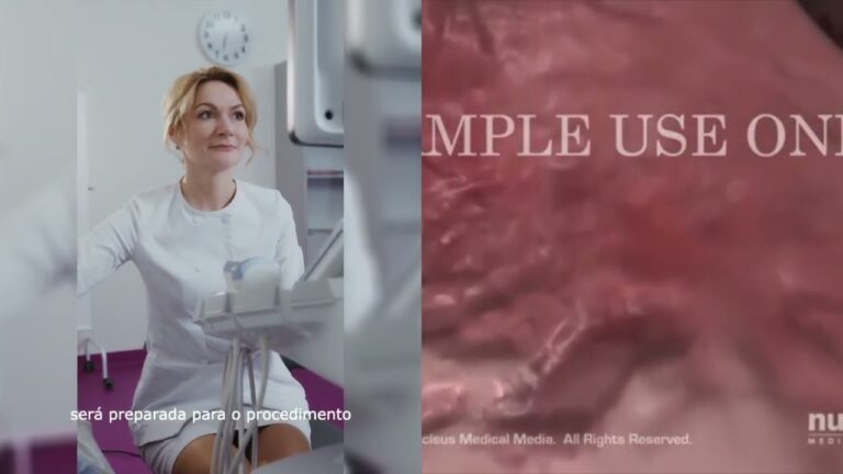 Anestesia Ideal para Curetagem: O Que Voc&ecirc; Precisa Saber