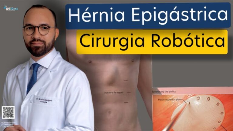 Hernioplastia Epigástrica: Abordagens e Resultados Eficazes