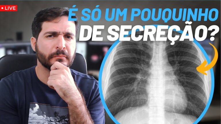Entendendo o Espessamento Peribronquico: Causas e Implicações