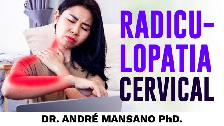 Tratamentos Eficazes para Radiculopatia Cervical