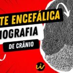Chás para saúde dos rins e vias urinárias
