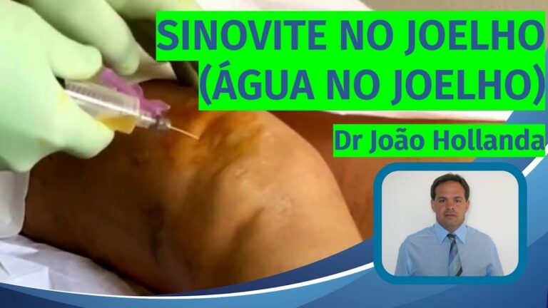 Entendendo a Membrana Sinovial do Joelho: Fun&ccedil;&otilde;es e Import&acirc;ncia