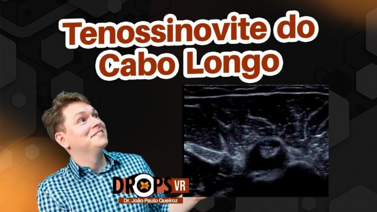 Entendendo a Tenossinovite do Cabo Longo do Bíceps: Causas e Tratamentos
